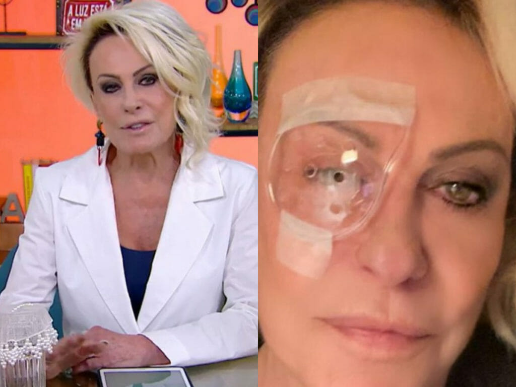 Ana Maria Braga Surge De ‘tapa Olho Após Cirurgia De Catarata Só Notícias 